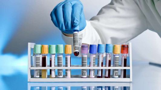 UK Diagnostics market has weathered to Covid-19 pandemic well. But will promised funding for diagnostics from the UK government materialise to meet a growing demand?